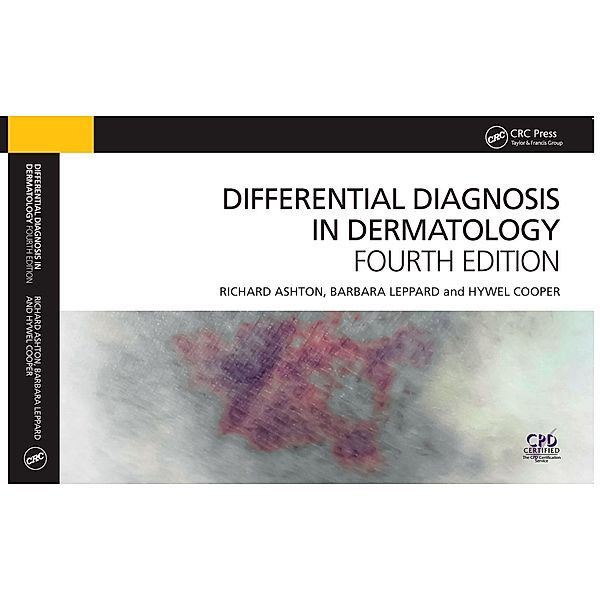 Differential Diagnosis in Dermatology, Richard Ashton, Barbara Leppard