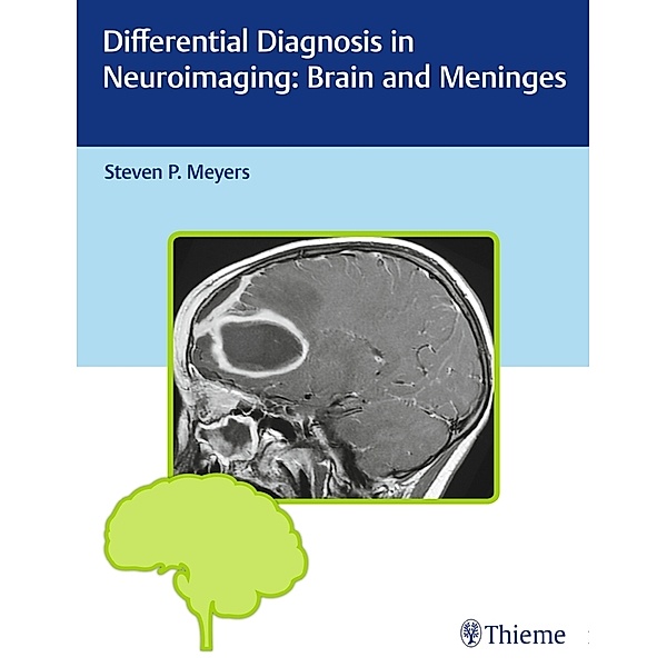 Differential Diagnosis in Neuroimaging / Differential Diagnosis in Neuroimaging: Brain and Meninges