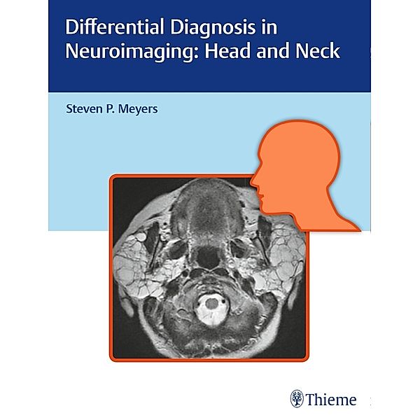 Differential Diagnosis in Neuroimaging / Differential Diagnosis in Neuroimaging: Head and Neck; .