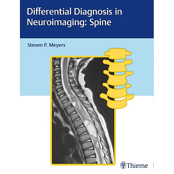 Differential Diagnosis in Neuroimaging / Differential Diagnosis in Neuroimaging: Spine; .