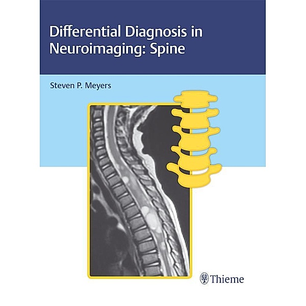 Differential Diagnosis in Neuroimaging: Spine