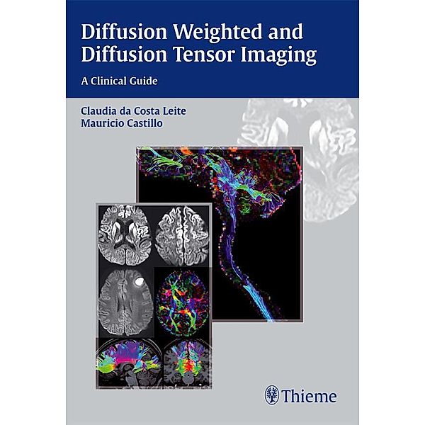 Diffusion Weighted and Diffusion Tensor Imaging: A Clinical Guide