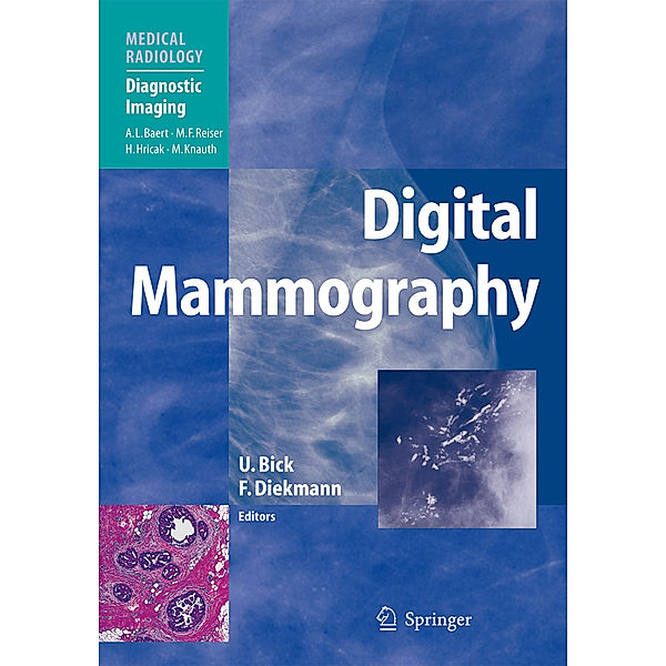 Digital Mammography