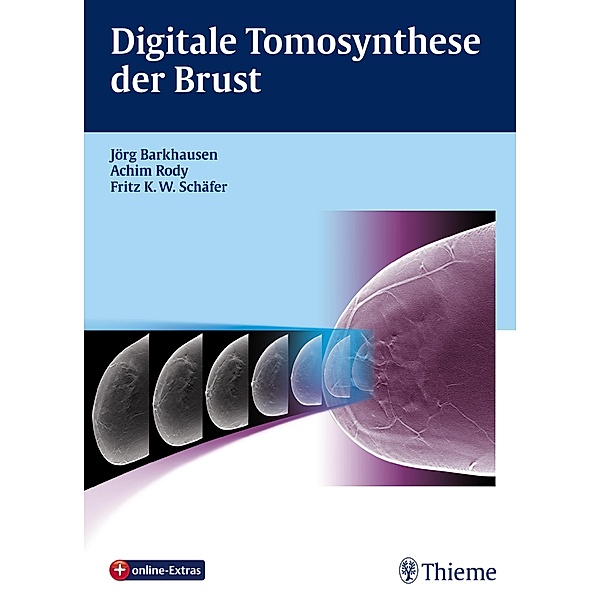 Digitale Tomosynthese der Brust, Jörg Barkhausen, Achim Rody, Fritz K. W. Schäfer