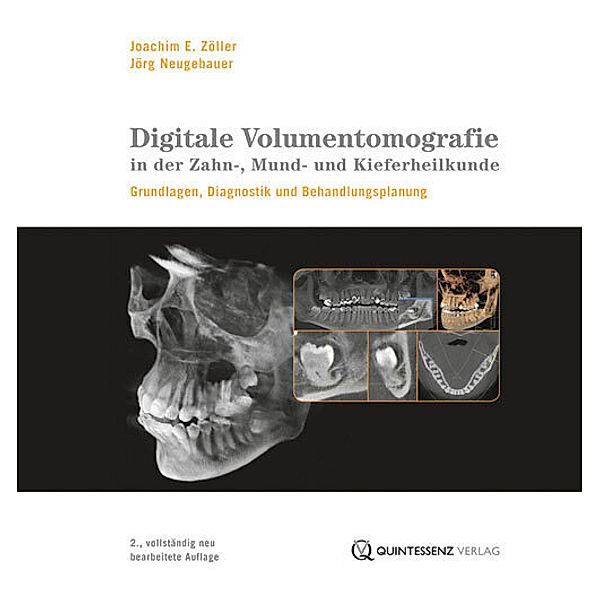Digitale Volumentomografie in der Zahn-, Mund- und Kieferheilkunde, m. DVD-ROM, Joachim E. Zöller, Jörg Neugebauer