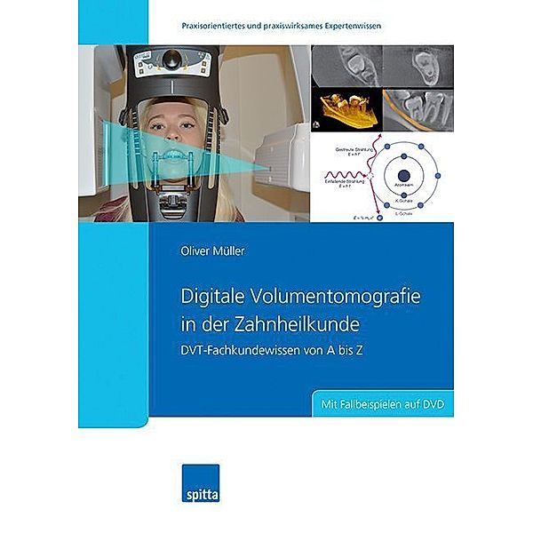 Digitale Volumentomografie in der Zahnheilkunde, m. DVD-ROM, Oliver Müller