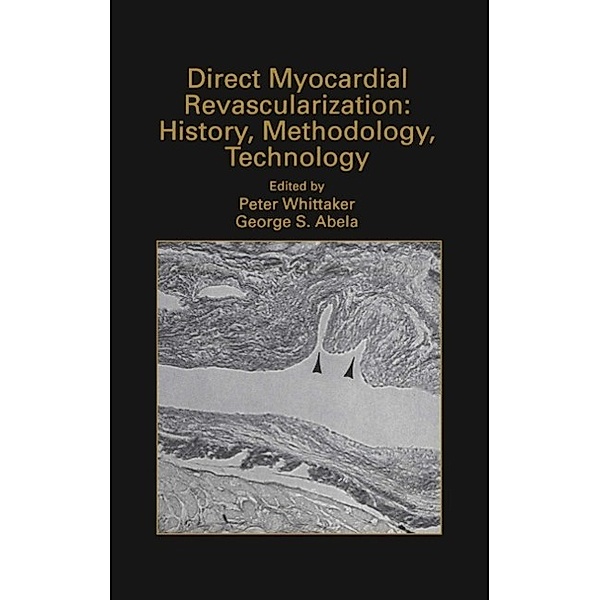 Direct Myocardial Revascularization: History, Methodology, Technology / Developments in Cardiovascular Medicine Bd.211