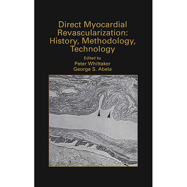Direct Myocardial Revascularization: History, Methodology, Technology