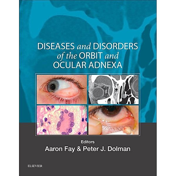 Diseases and Disorders of the Orbit and Ocular Adnexa E-Book, Aaron Fay, Peter J Dolman