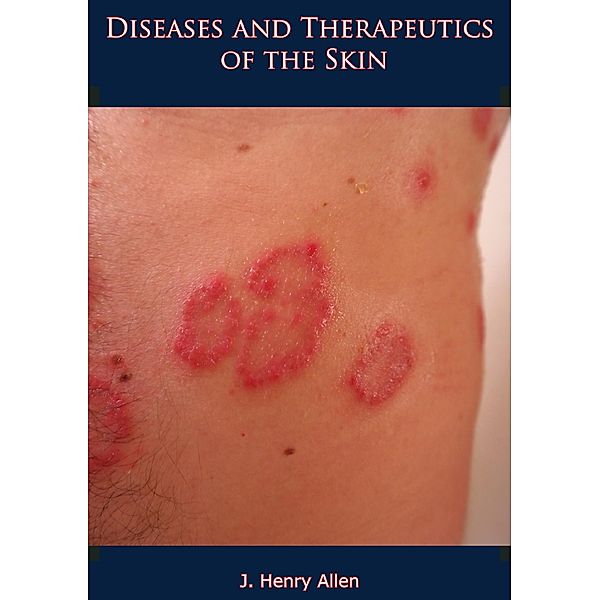 Diseases and Therapeutics of the Skin / Barakaldo Books, J. Henry Allen