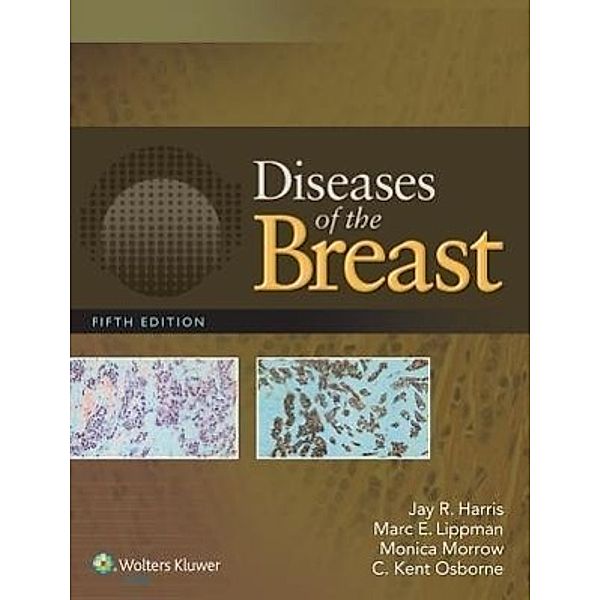 Diseases of the Breast 5e, Jay R. Harris