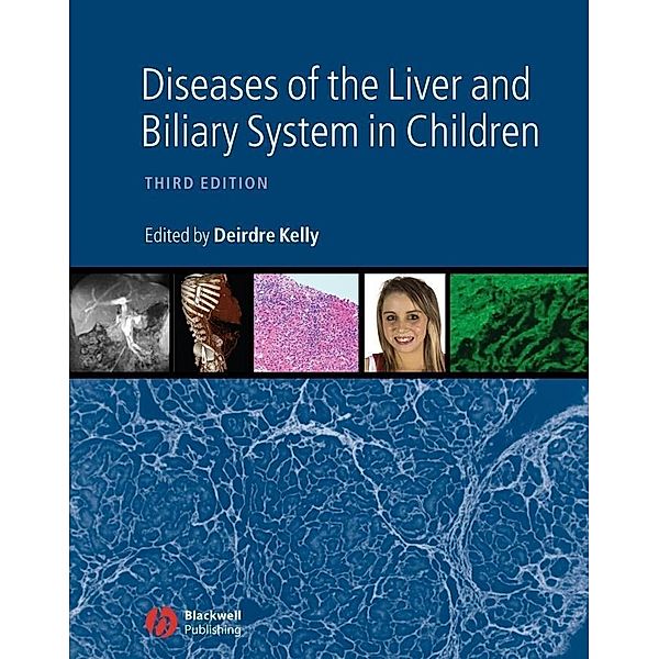 Diseases of the Liver and Biliary System in Children