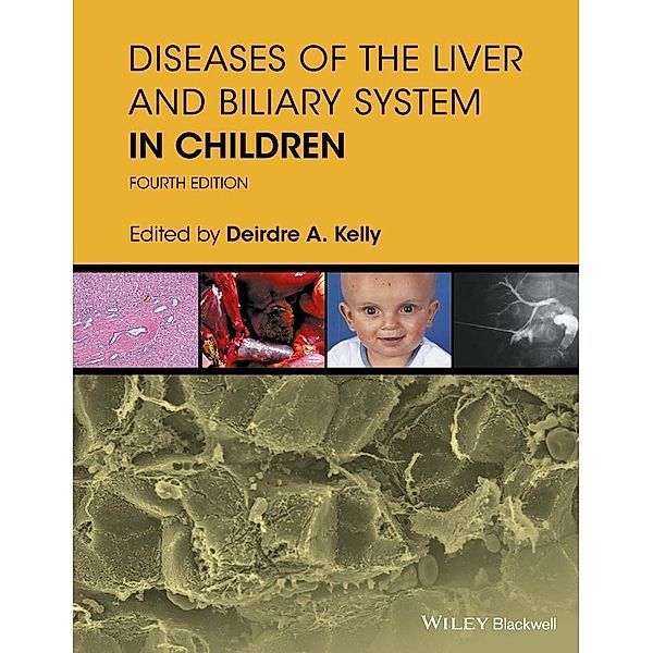 Diseases of the Liver and Biliary System in Children