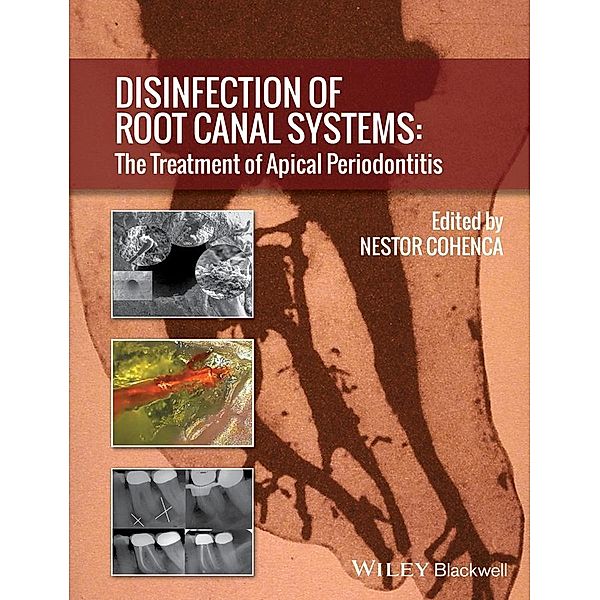 Disinfection of Root Canal Systems