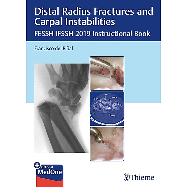 Distal Radius Fractures and Carpal Instabilities