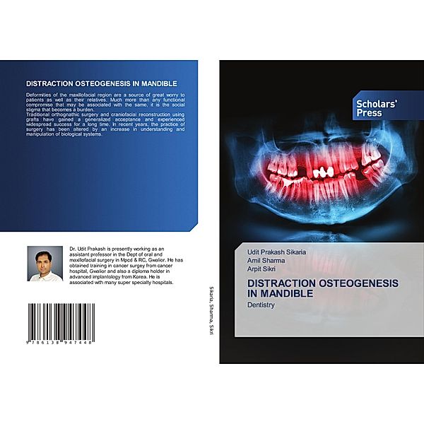 DISTRACTION OSTEOGENESIS IN MANDIBLE, Udit Prakash Sikaria, Amil Sharma, Arpit Sikri