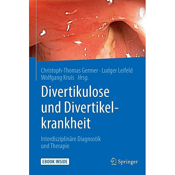 Divertikulose und Divertikelkrankheit