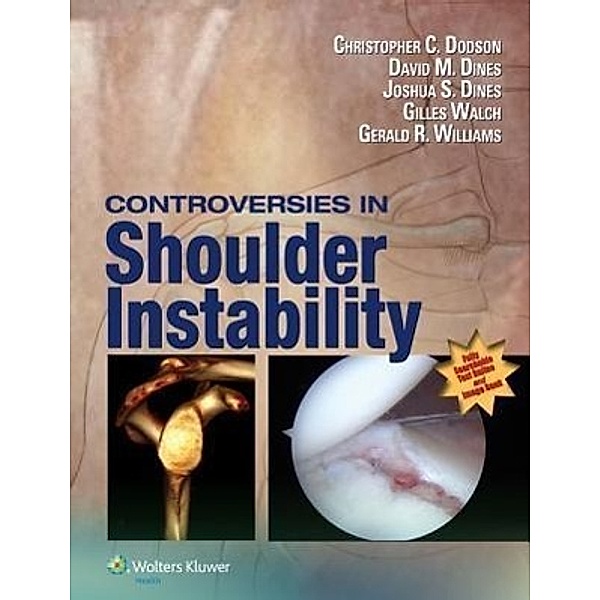 Dodson, C: Controversies in Shoulder Instability, Christopher Dodson, David M. Dines, Joshua S. Dines, Gilles Walch, Gerald R. Williams