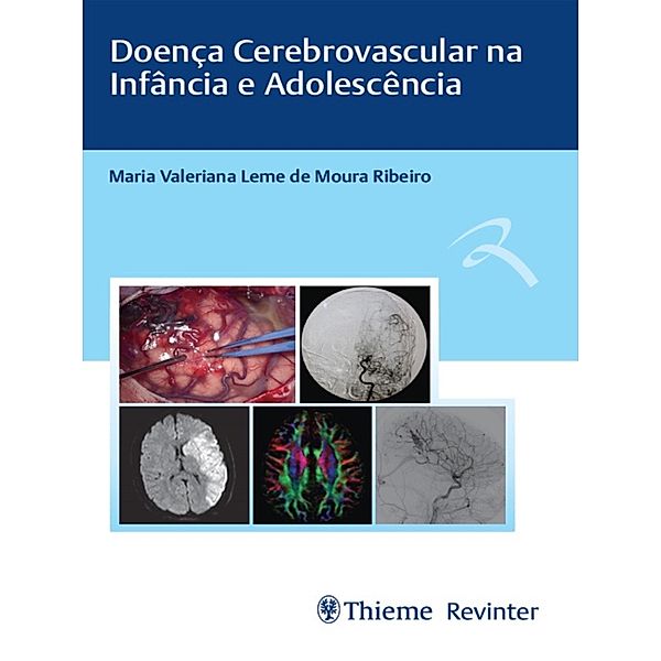 Doença Cerebrovascular na Infância e Adolescência, Maria Valeriana Leme de Moura Ribeiro