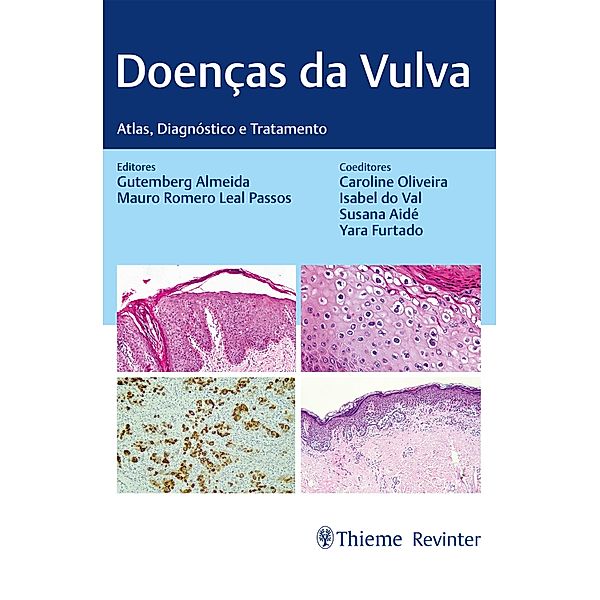 Doenças da Vulva, Gutemberg Almeida, Mauro Romero Leal Passos