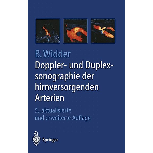 Doppler- und Duplexsonographie der hirnversorgenden Arterien, B. Widder