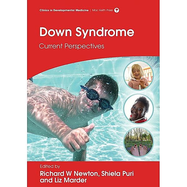 Down Syndrome, Richard W Newton, Liz Marder, Shiela C Puri
