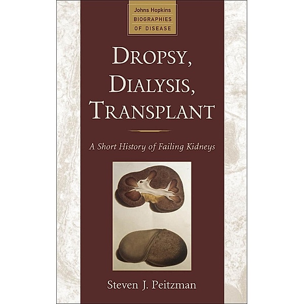 Dropsy, Dialysis, Transplant, Steven J. Peitzman