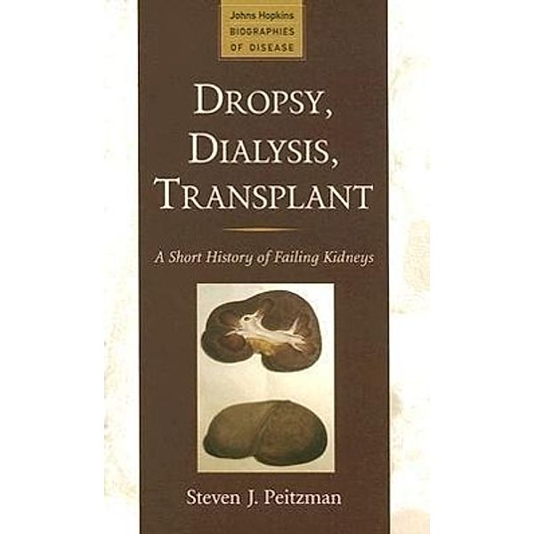 Dropsy, Dialysis, Transplant: A Short History of Failing Kidneys, Steven J. Peitzman