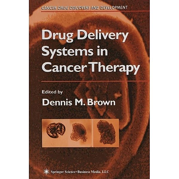 Drug Delivery Systems in Cancer Therapy / Cancer Drug Discovery and Development