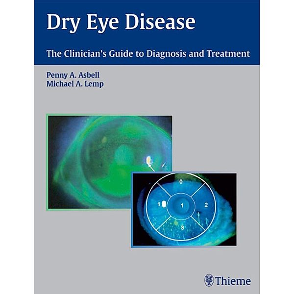 Dry Eye Disease