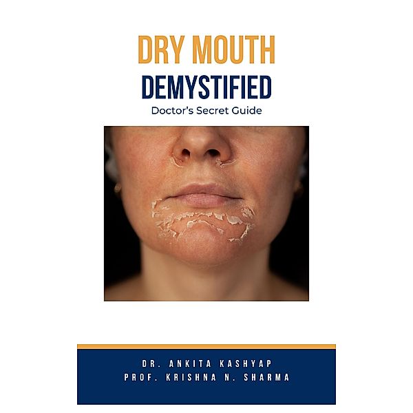 Dry mouth Demystified: Doctor's Secret Guide, Ankita Kashyap, Krishna N. Sharma