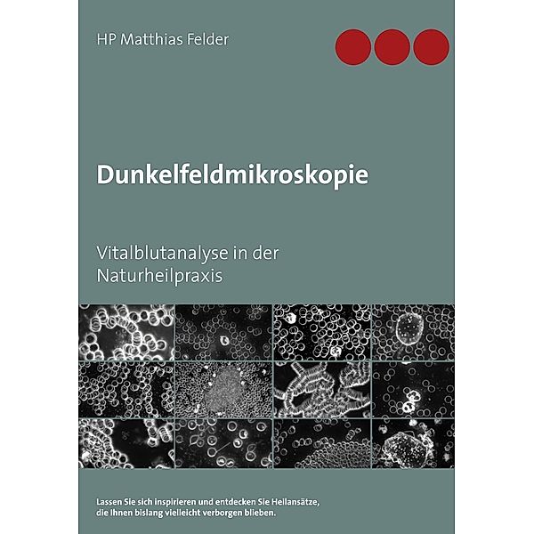 Dunkelfeldmikroskopie, Matthias Felder