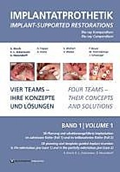 DVD-Kompendium Implantatprothetik 1 - DVD, Filme - Karl-Ludwig Ackermann, Axel Kirsch, Gerhard Neuendorff,