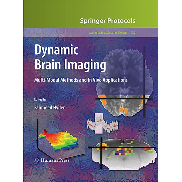 Dynamic Brain Imaging