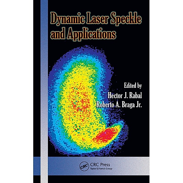 Dynamic Laser Speckle and Applications