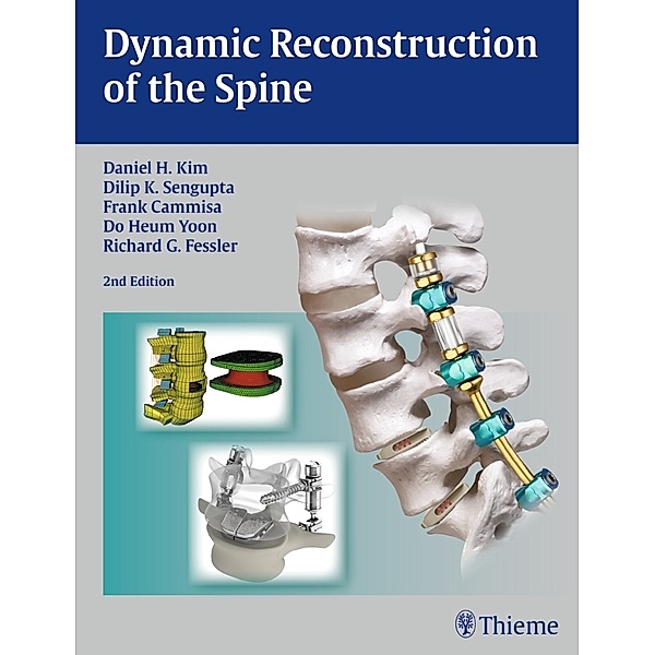 Dynamic Reconstruction of the Spine, Daniel H. Kim, Dilip K. Sengupta, Frank P. Cammisa Jr., Richard G. Fessler, Do Heum Yoon