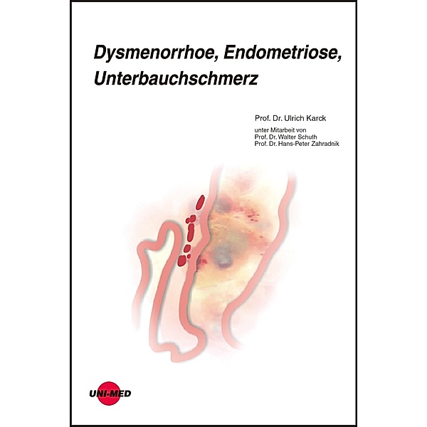 Dysmenorrhoe, Endometriose, Unterbauchschmerz / UNI-MED Science, Ulrich Karck