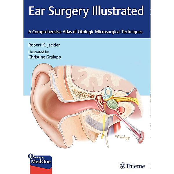 Ear Surgery Illustrated, Robert K. Jackler