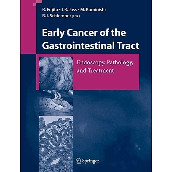 Early Cancer of the Gastrointestinal Tract, Michio Kaminishi, Rikiya Fujita