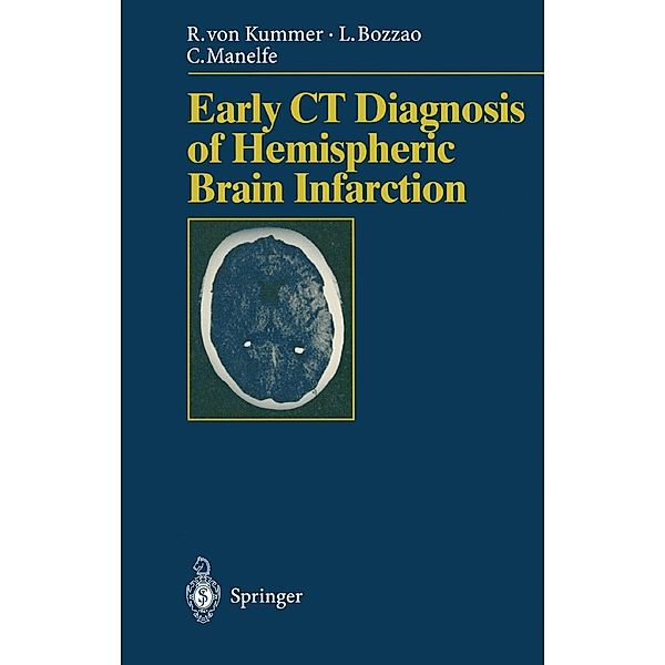 Early CT Diagnosis of Hemispheric Brain Infarction, Rüdiger V. Kummer, Luigi Bozzao, Claude Manelfe