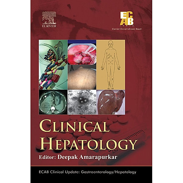 ECAB Clinical Hepatology - E-Book