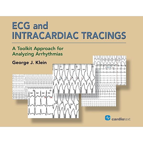 ECG and Intracardiac Tracings, George J. Klein