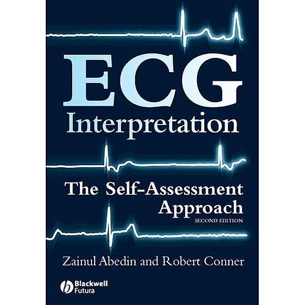 ECG Interpretation, Zainul Abedin, Robert Conner