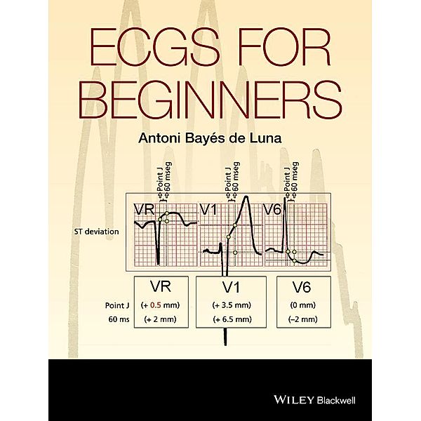 ECGs for Beginners, Antoni Bayés de Luna