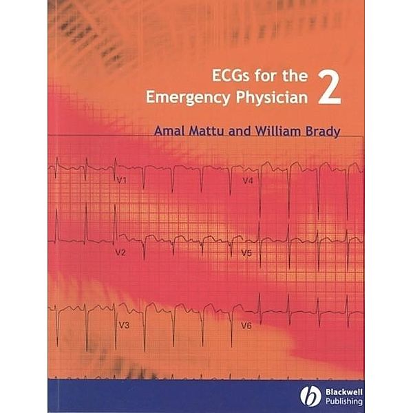 ECGs for the Emergency Physician 2, Amal Mattu, William J. Brady