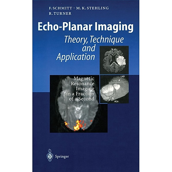 Echo-Planar Imaging, Franz Schmitt, Michael K. Stehling, Robert Turner
