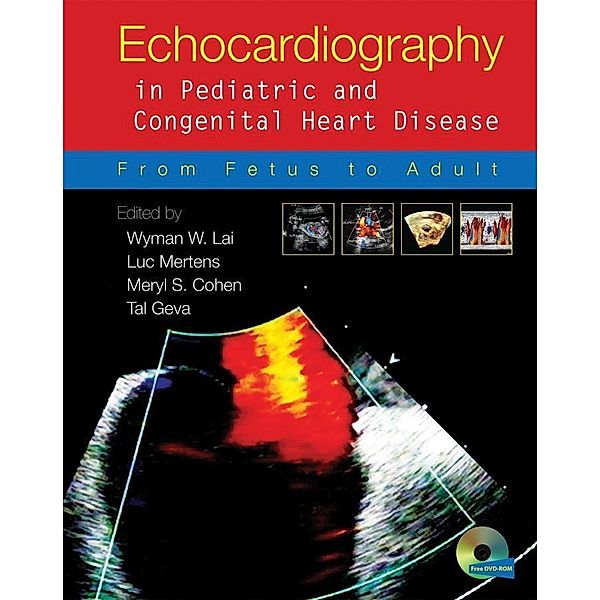 Echocardiography in Pediatric and Congenital Heart Disease