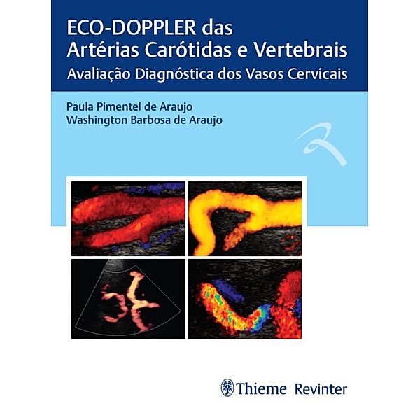 ECO-DOPPLER das Artérias Carótidas e Vertebrais, Paula Pimentel de Araujo, Washington Barbosa de Araujo