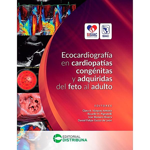 Ecocardiografía en Cardiopatías Congénitas y Adquiridas del Feto al Adulto, Clara Antona A. Vázquez, Ricardo H. Pignatelli, Iván Romero Rivera, Daniel Felipe Guzzo de León