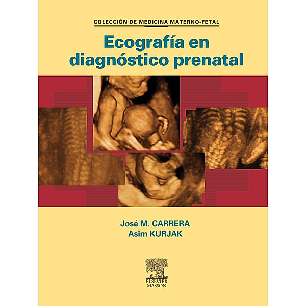 Ecografía en diagnóstico prenatal, José María Carrera